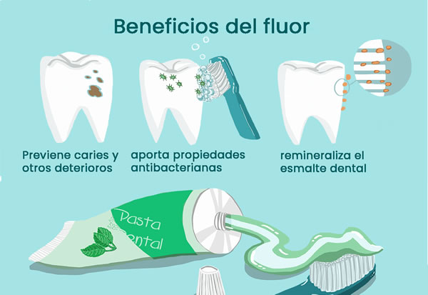 Beneficios del Fluor Dental| Clínica Dental Artdenta Valencia