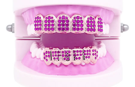 Muestra Gritz Joyas dentales | Clínica Dental Artdenta Valencia