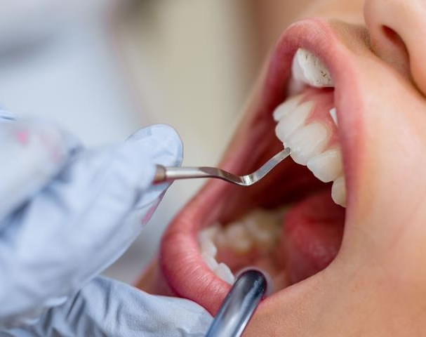Revisando Peno Dental | Clínica Dental Artdenta Valencia