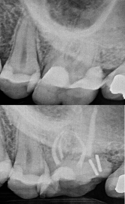 Peno Dental | Clínica Dental Artdenta Valencia