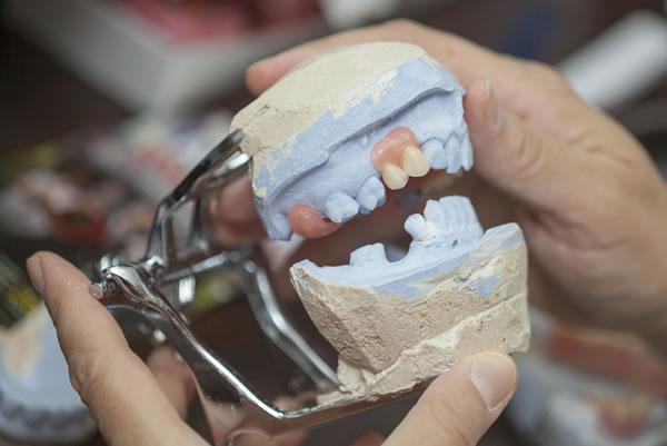 Laboratorio Rechazo Implante Dental | Clínica Dental Artdenta Valencia