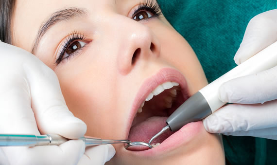 Revisando sarro - Raspadores dentales | Clínica Dental Artdenta en Valencia