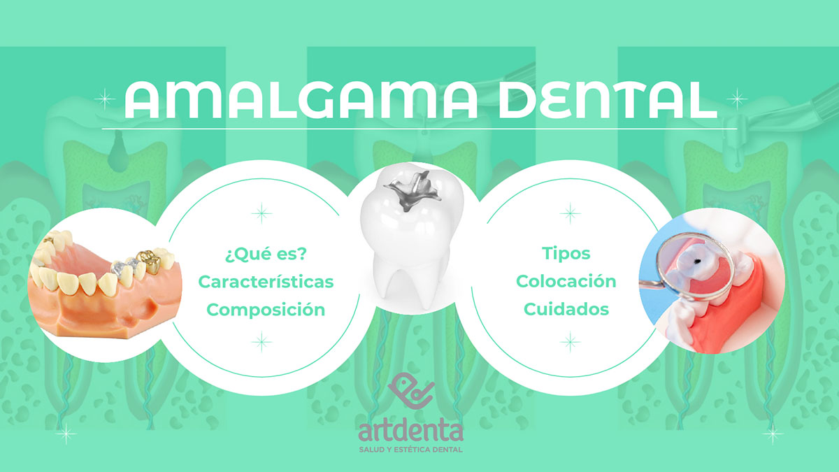 Banner Amalgama Dental | Clínica Dental Artdenta Valencia