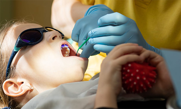 Eliminación de Placa Dental | Clínica Dental Artdenta Valencia