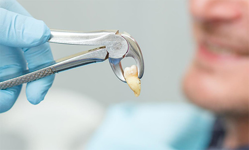 Premolar Forceps Dental | Clínica Dental Artdenta Valencia
