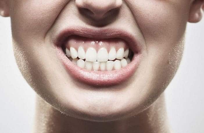 Bruxismo - Clínica Dental en Valencia Benimaclet ARTDENTA