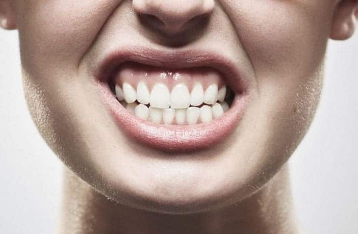 Bruxismo - Clínica Dental en Valencia Benimaclet ARTDENTA