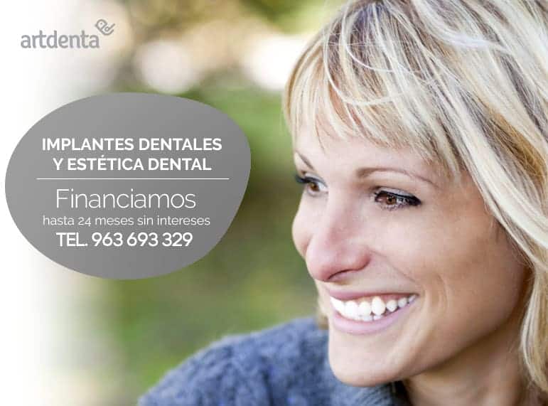 Promoción Implantología - Clínica Dental en Valencia Benimaclet ARTDENTA
