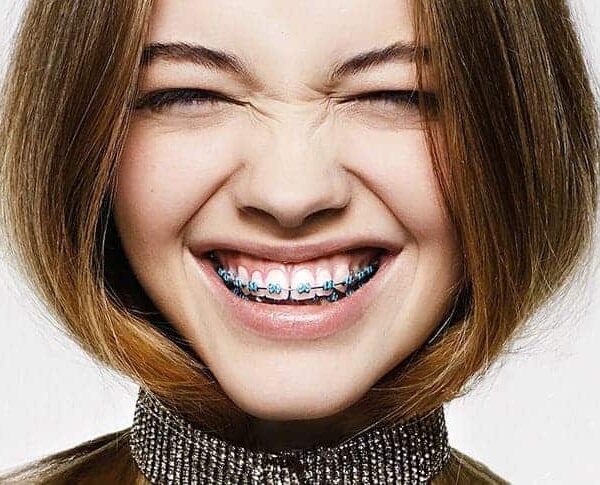 Salud Estética dental - Clínica Dental en Valencia Benimaclet ARTDENTA