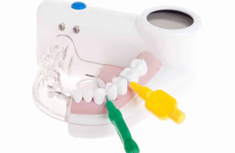 Periodontitis Ardenta Dental Valencia