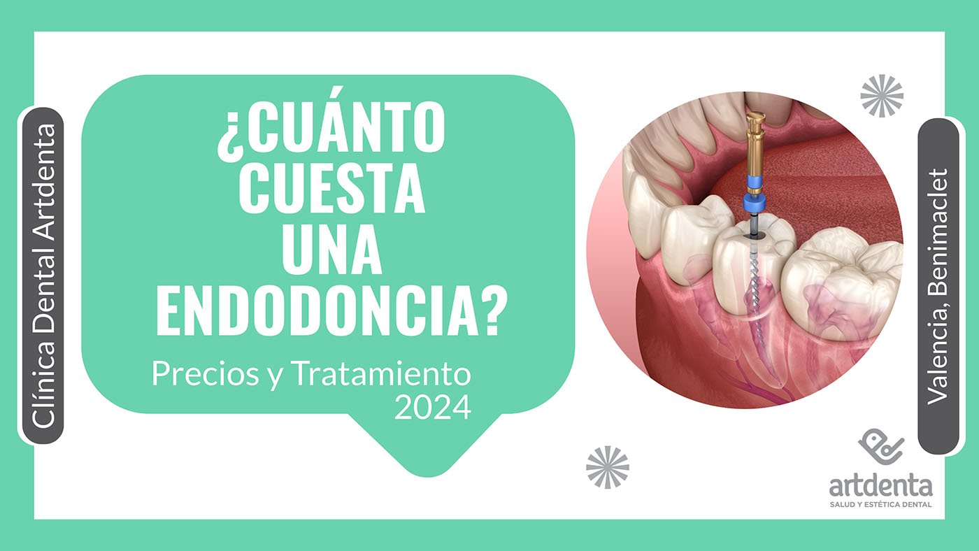 Precio Endodoncia Valencia | Clínica Dental Artdenta Valencia