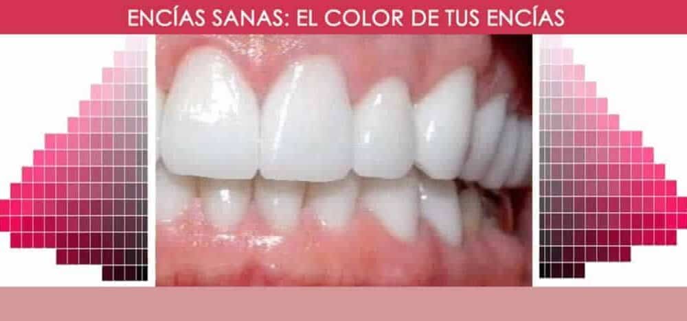 Encías sanas || Color de las encías