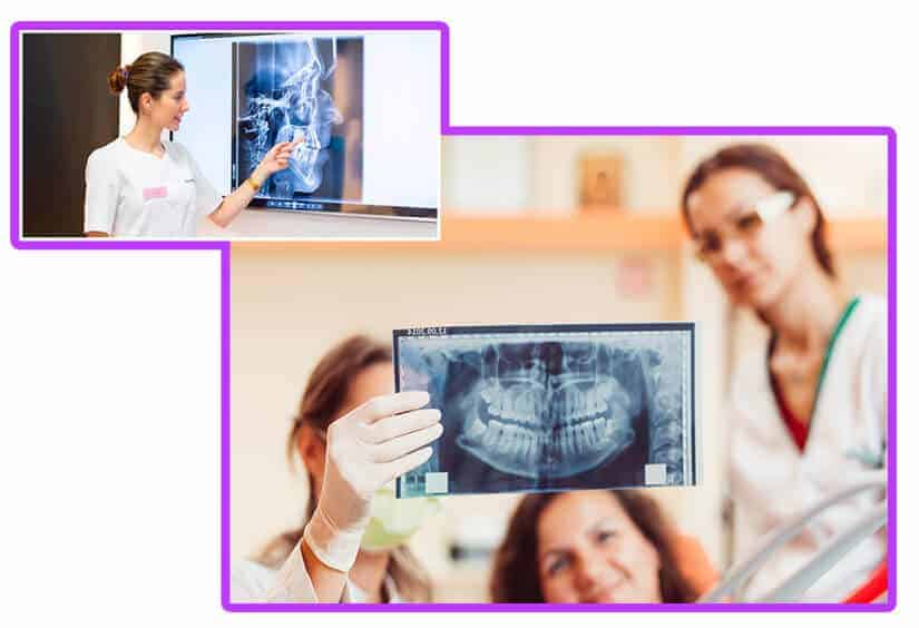 Preoperatorio implantes