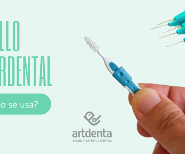 Banner Uso de cepillo interdental | Clínica Dental Artdenta Valencia