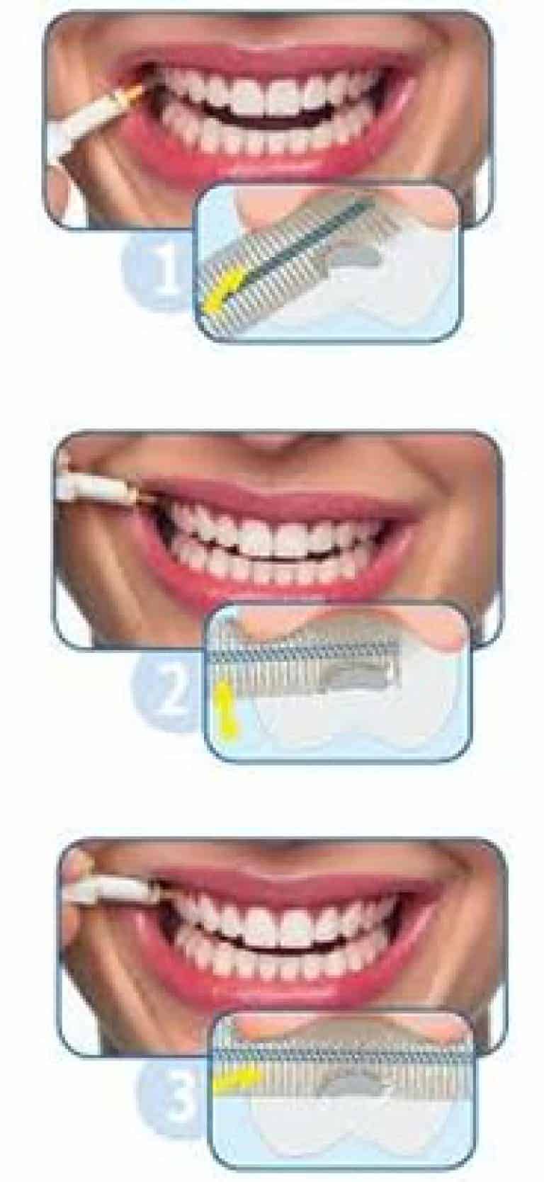 Cepillo Interdental ¿qué Es Y Como Se Utiliza Clínica Dental En