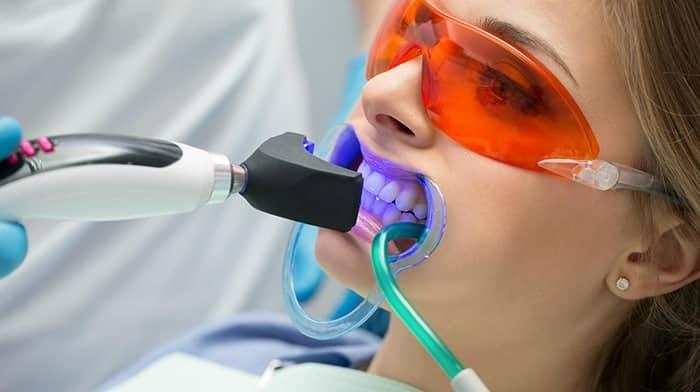 Blanqueamiento dental | Cl&iacute;nica Dental Artdenta Valencia
