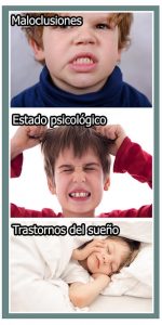 Bruxismo en niños causas