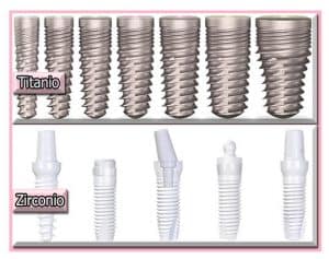 Tipos de implantes según material