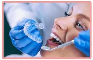 Quien coloca la ortodoncia invisalign