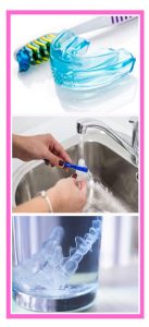 Cómo se limpia una Férula de descarga?  Clínica Dental en VALENCIA -  Benimaclet