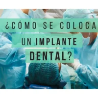 Banner como se coloca un Implante dental | Clínica Dental Artdenta Valencia