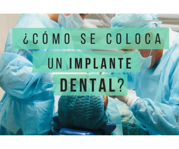 Banner como se coloca un Implante dental | Clínica Dental Artdenta Valencia