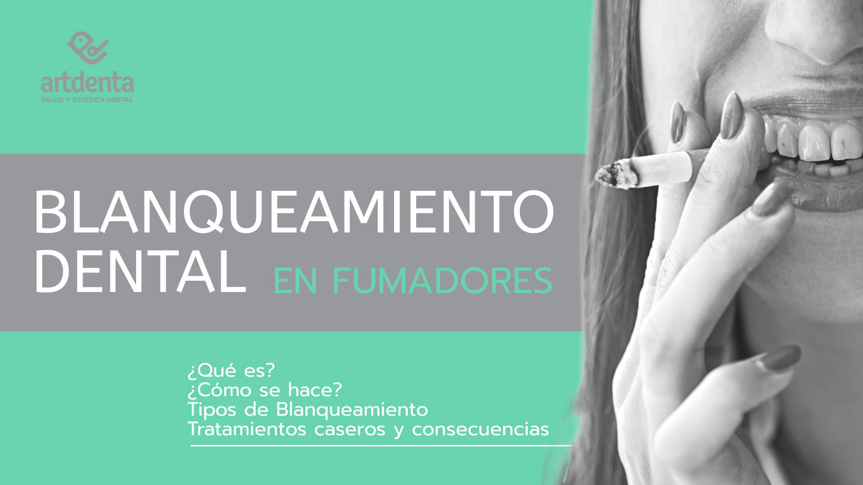 Blanqueamiento Dental en Fumadores | Clínica Dental Artdenta Valencia