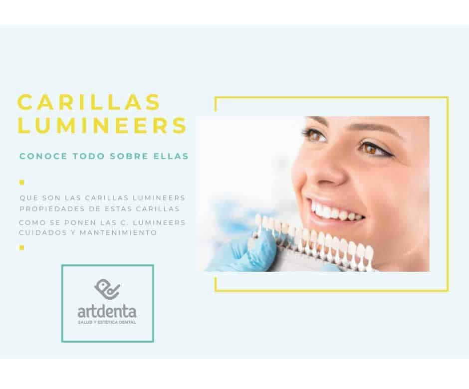 Todo sobre las Carillas Lumineers || Clínica dental en Valencia Artdenta