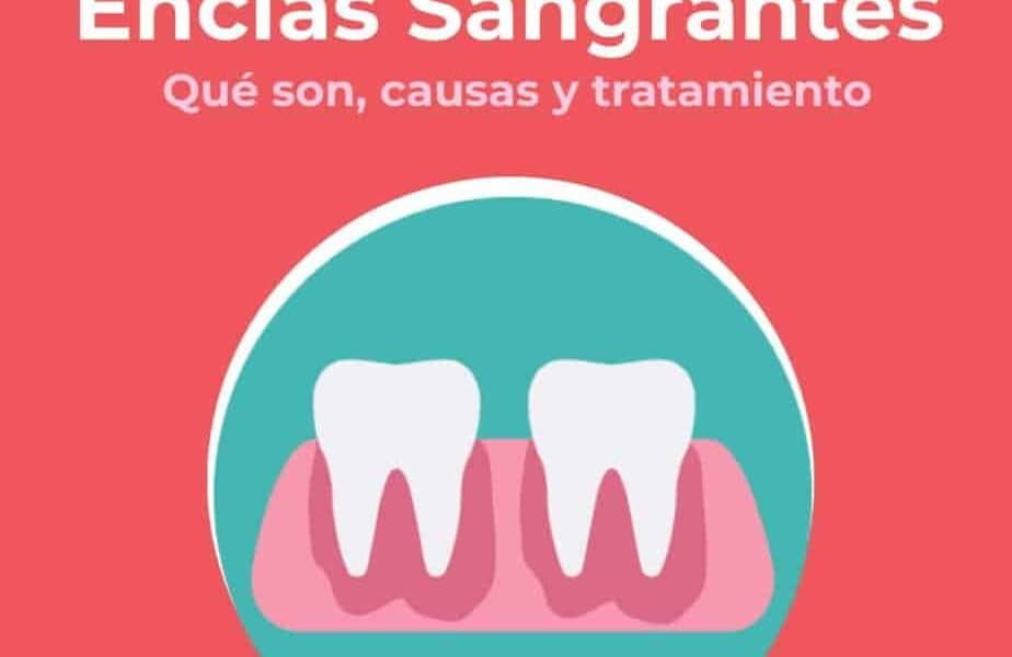 Encías Sangrantes | Clínica Dental en Valencia Artdenta
