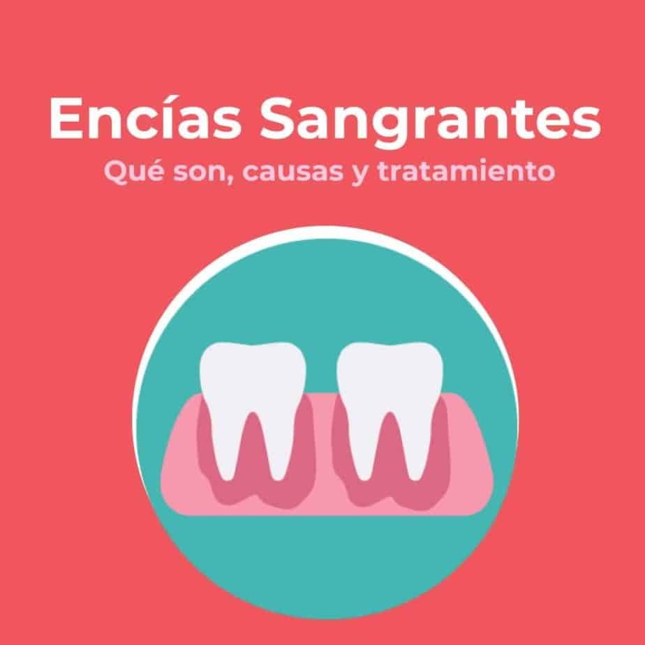 Encías Sangrantes Causas Y Tratamiento Clínica Dental En Valencia Benimaclet 4505