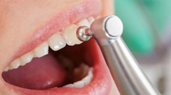 Técnica de Pulido Dental Artdenta