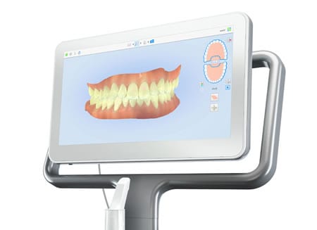 Escaner para Férula de Descarga | Clínica Dental Artdenta