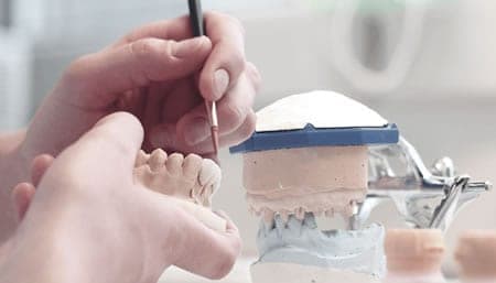Fabricación de Férula de Descarga | Clínica Dental Artdenta