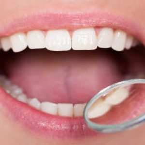 Revisar Caries y Empastes Dentales | Clínica Dental Artdenta Valencia