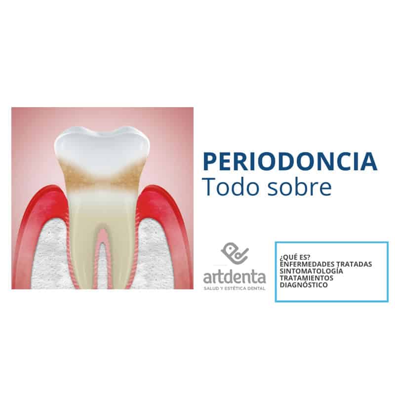Banner | Todo sobre Periodoncia | Clínica Dental Artdenta Valencia