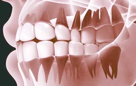 Rayos Equis | Periodoncia | Clínica Dental Artdenta en Valencia