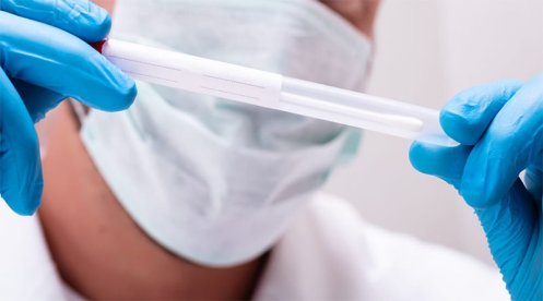 Análisis Papiloma Humano Bucal | Clínica Dental Artdenta Valencia