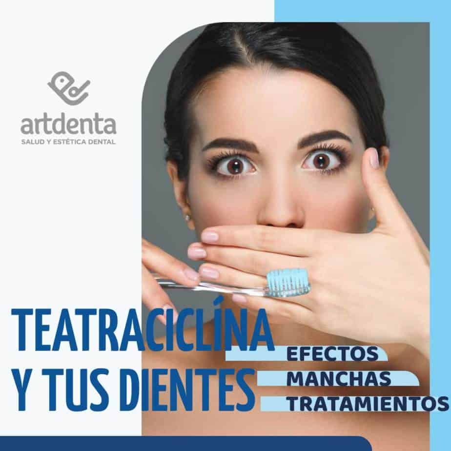 Banner Manchas por tetraciclina en Dientes | Clínica Dental Artdenta Valencia