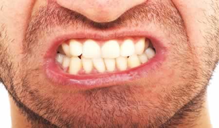 Actividad Dental Parafuncional | Clínica Dental Artdenta Valencia
