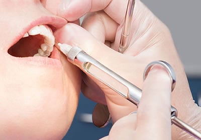 Anestesia Implante Dental | Dental Artdenta Valencia