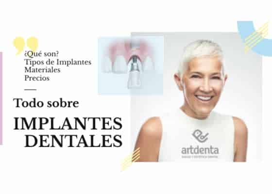 Todo sobre Implantes Dentales | Clínica Dental Artdenta Valencia