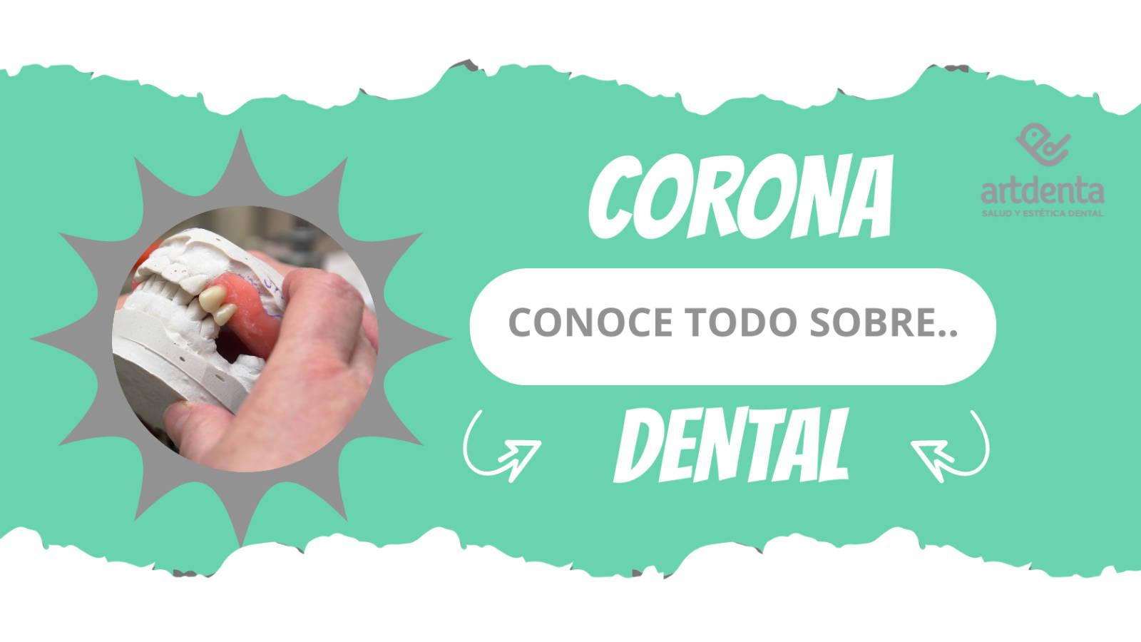 Banner Corona Dental | Clínica Dental Artdenta Valencia