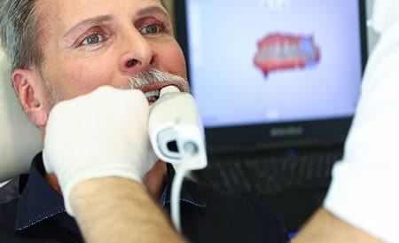 Dentista colocando Corona Dental | Clínica Dental Artdenta Valencia