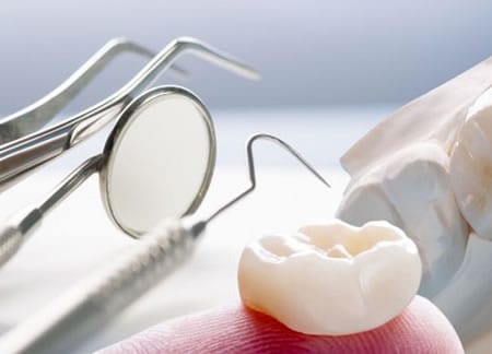 Utensilios para implantar Corona Dental | Clínica Dental Artdenta Valencia