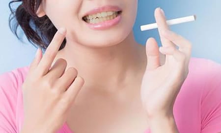 Tabaco y la Periimplantitis | Dental Artdenta Valencia
