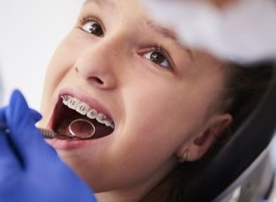 Odontopediatría Ortodoncia infantil | Clínica Dental Artdenta Valencia