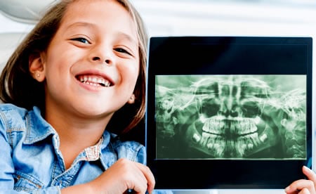 Odontopediatría Radiografía infantil | Clínica Dental Artdenta Valencia