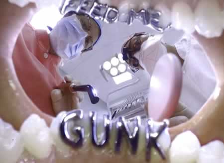 Colocaci&oacute;n de Gritzz en Dientes | Cl&iacute;nica Dental Artdenta Valencia