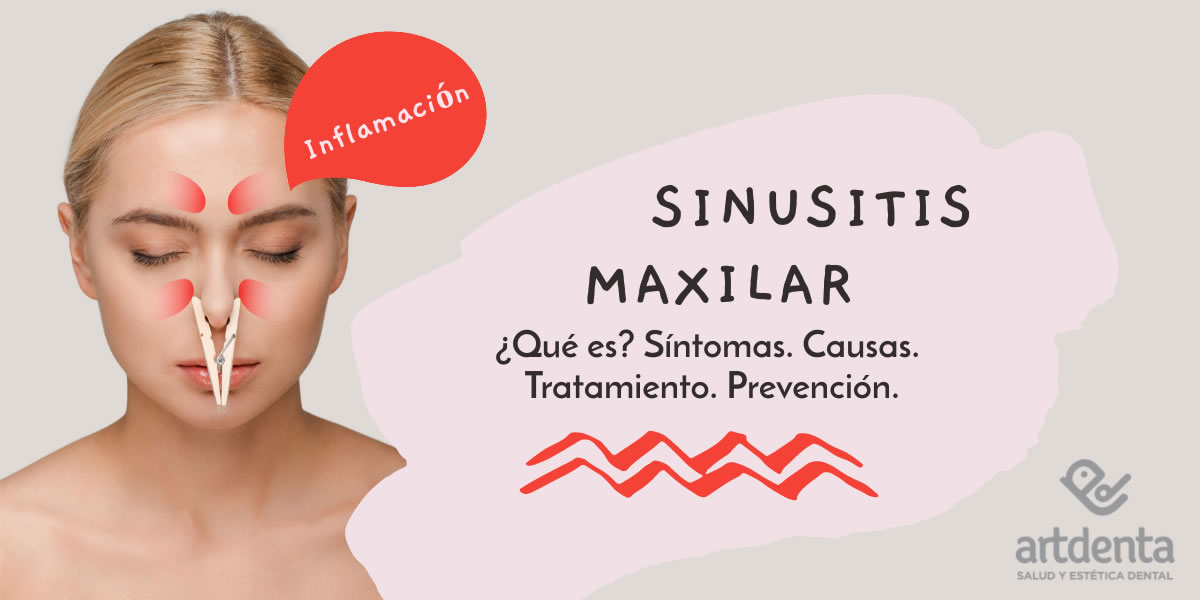 Sinusitis Maxilar | Clínica Dental Artdenta Valencia