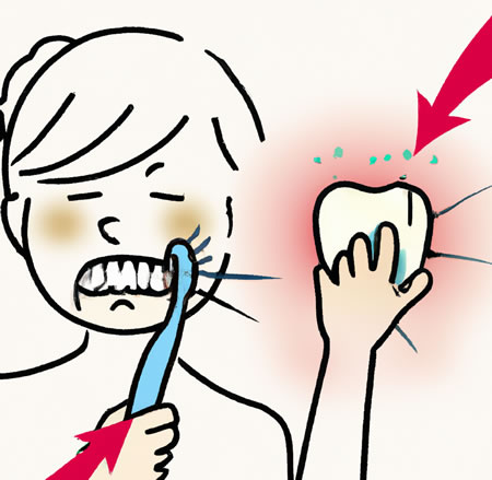 Clorhexidina - gingivitis | Cl&iacute;nica Dental Artdenta Valencia